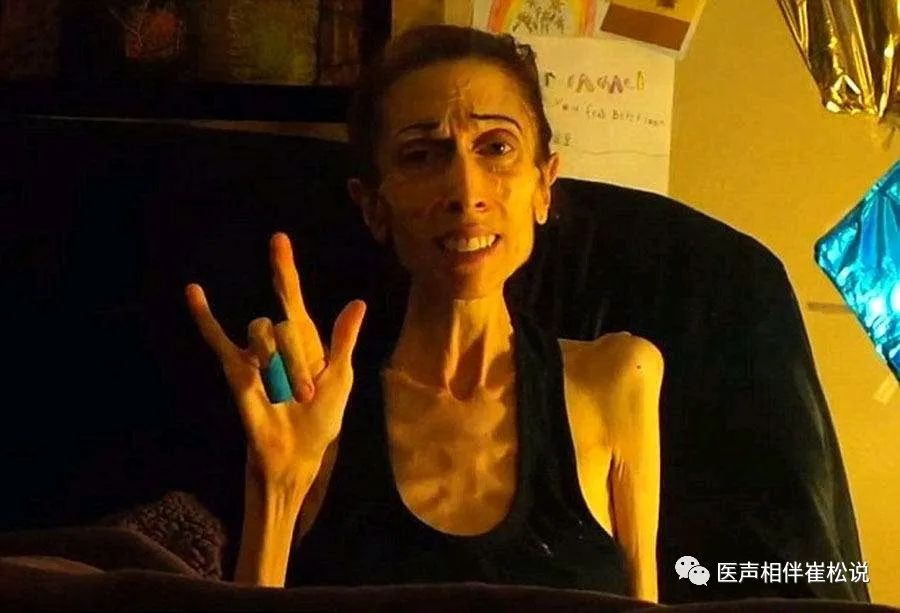骨瘦如柴电影，小巷深处的隐藏瑰宝